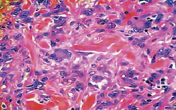 Identifican células capaces de regenerar el hígado sin causar cáncer