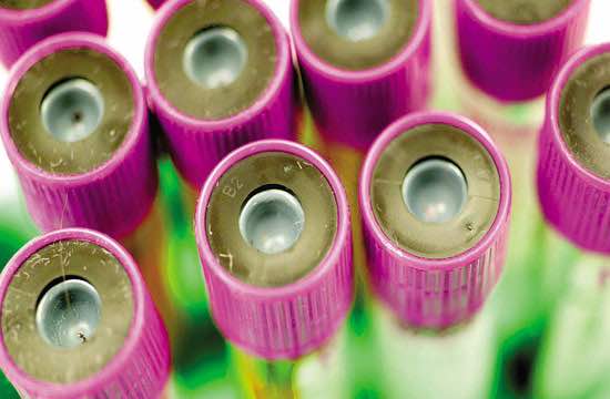 Diseñan prueba para anticipar reaparición de cáncer en pacientes