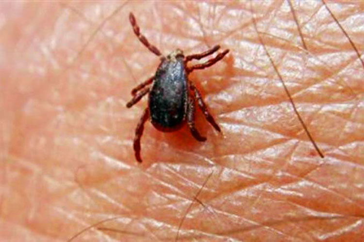 Teme Salud por casos de Rickettsia en Ciudad Victoria