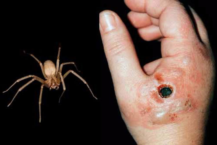 Alerta en Victoria por presencia de araña “Violinista”