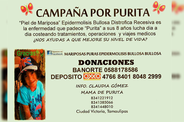 Apoyo Ciudadano: ‘Purita’ necesita de tu apoyo
