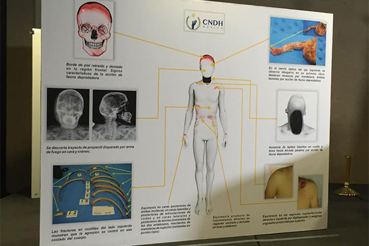 Forenses argentinos avalan dictamen de CNDH sobre normalista