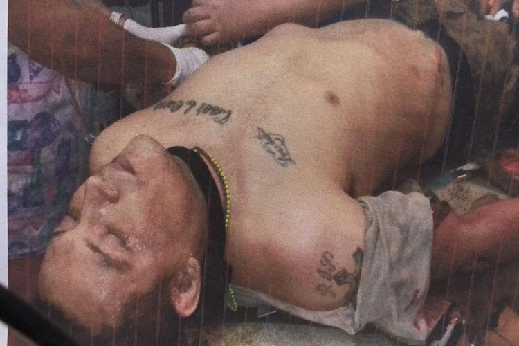 Difunden foto de “El Kevin”, rescatado en emboscada a militares