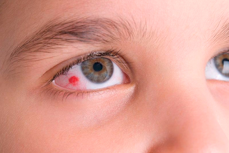 Denuncia Güémez brote de enfermedades dérmicas y oculares