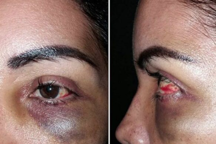 Secretario Gobierno golpea a su mujer