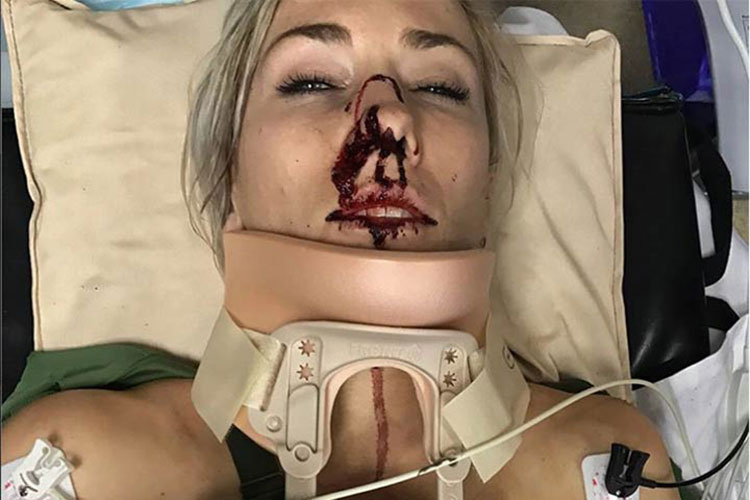 Campeona mundial de BMX sufre terrible accidente