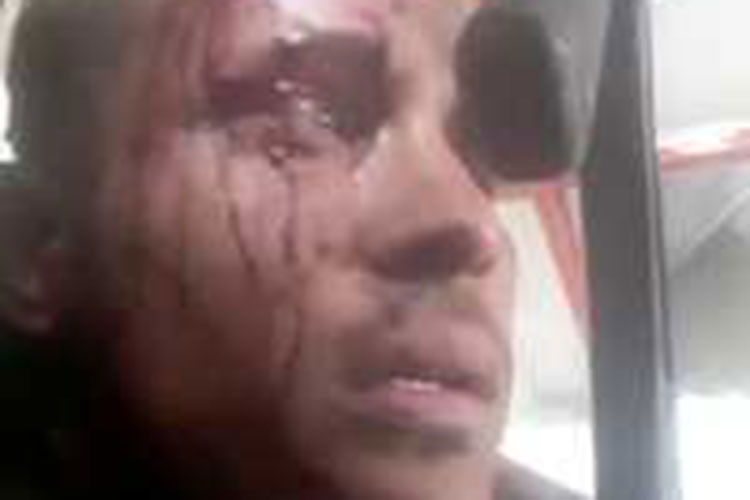 Venezuela: varios muertos en operación contra ex agente