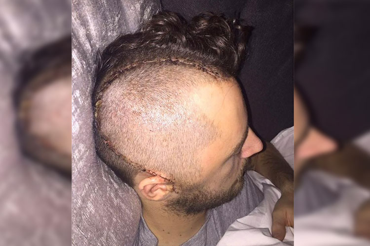 Ryan Mason se retira del futbol por un golpe en la cabeza