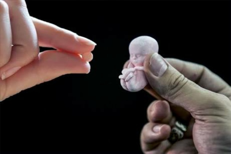 Registran repunte de abortos en Victoria