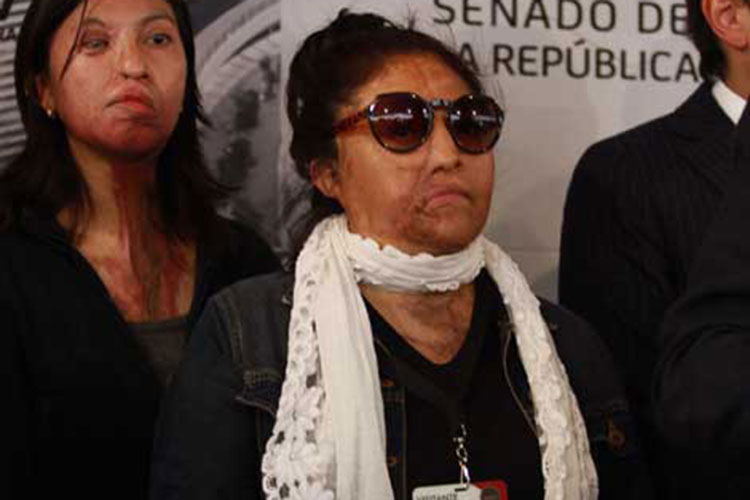 Promueven mayor sentencia a quien lesione a mujeres