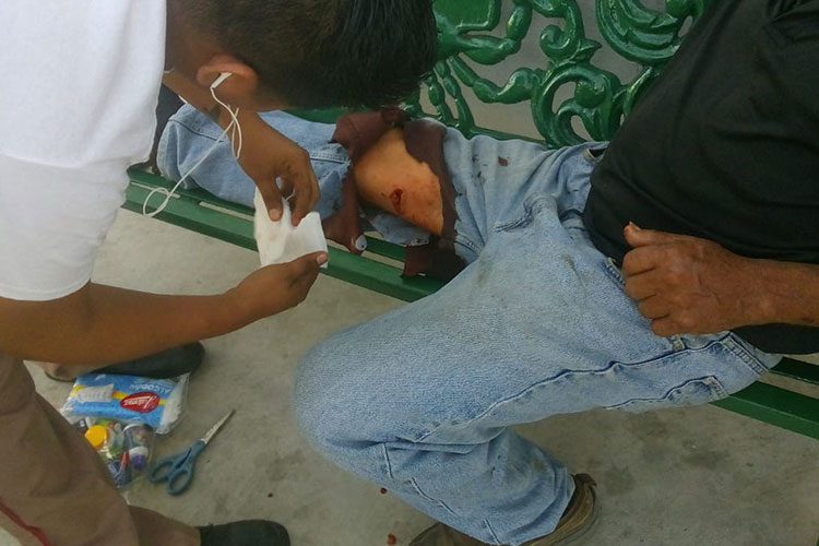 Despistado ciudadano es atacado por un cocodrilo en Tampico