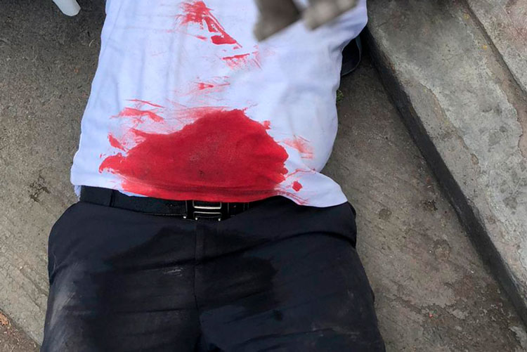Hieren de bala a estudiante del CBTIS 119 en Victoria