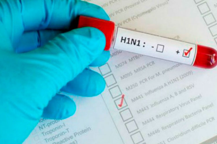 A 11 años de la crisis sanitaria en México por la influenza H1N1