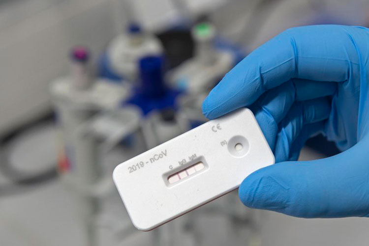 Oleada de pruebas de coronavirus crea confusión en EEUU