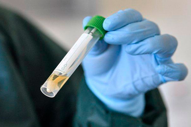 Analizan 19 casos sospechosos a COVID-19 en Tamaulipas