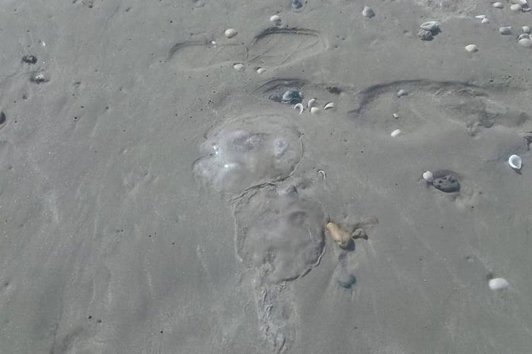 Aguas malas atacan a 12 personas en playa Miramar
