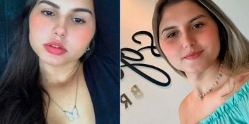 Gemelas trans se someten juntas a cirugía de reasignación de género en Brasil