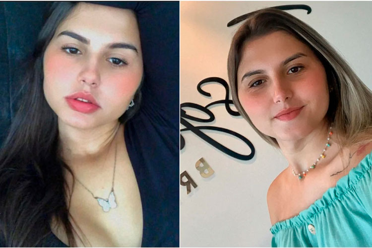 Gemelas trans se someten juntas a cirugía de reasignación de género en Brasil