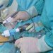 Combate IMSS e ISSSTE obesidad con bypass