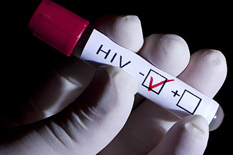 VIH disminuye en Tamaulipas, pero persisten focos críticos